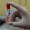 Tubo de sangre vacío usado en la detección del COVID-19. Foto: Prasesh Shiwakoti (Lomash) (@lomash_s)