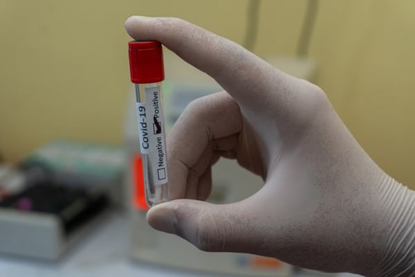 Tubo de sangre vacío usado en la detección del COVID-19. Foto: Prasesh Shiwakoti (Lomash) (@lomash_s)
