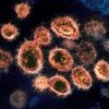 Imagen del SARS-CoV-2 (el virus causante de la pandemia del COVID-19). Foto: NIH Image Gallery / NIAID-RML (Dominio público). Blog Elcano