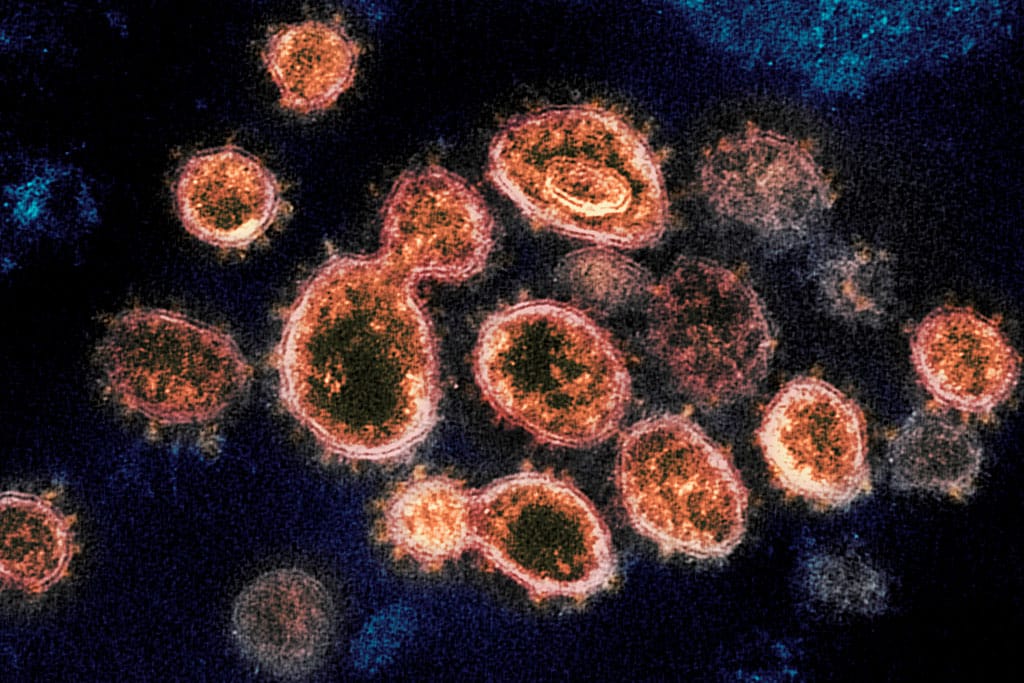 Image of SARS-CoV-2 (the virus causing the COVID-19 pandemic). Photo: NIH Image Gallery / NIAID-RML (Public domain). Elcano Blog